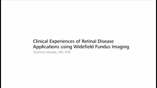 Clinical Experiences of Retinal Disease Applications using Widefield Fundus Imaging [upl. by Swayder808]