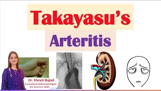 Takayasu Arteritis  Dr Shruti Bajad skincare arthritis autoimmunecare skin arthritispain [upl. by Puduns112]