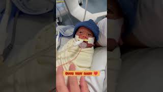 Premature baby labour room NICU 🥹❤️❤️shortsviral reels reelsindia [upl. by Grissom]