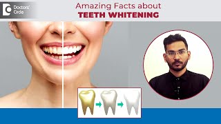 FACTS about Teeth Whitening  Food restrictions after Teeth WhiteningDrRajaram S  Doctors Circle [upl. by Riba]