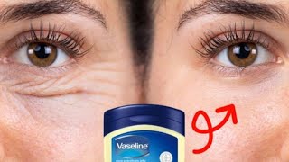 Vaseline Erases All Wrinkles TOP AntiAging Mask Remedies for Wrinkle Removal [upl. by Drofyar507]