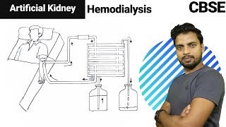 How to draw Artificial Kidney HAEMODIAYSIS [upl. by Eesac]