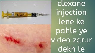 clexane injection in pregnancy [upl. by Mccreery]