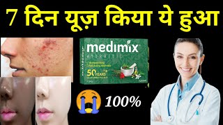 honest review medimix soapmedimix soap 2022medimix soap useshow to get fair skinmedimix soap [upl. by Sukramed]