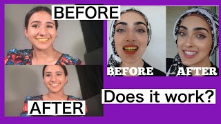 Immy Maryam’s secret teeth whitening remedy does it truly work [upl. by Armahs]