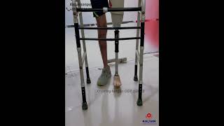 Above knee Artificial leg [upl. by Dynah]