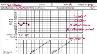 Partograph  How to plot the Partograph A step by step guide griphsacademy2024 [upl. by Giacobo50]