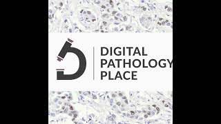 107 DigiPath Digest 13 Revolutionizing Pathology with AI Insights from PD1 to Prostate Cance [upl. by Dorelle]