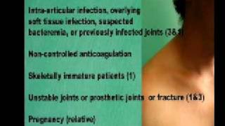 Subacromial Shoulder Joint Injection [upl. by Cherye]