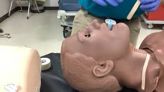 Oropharyngeal airway insertion [upl. by Ahsaten]