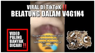 Viral‼️ Belatung Dalam V4g1n4 Di Tiktok Ini Kata Ahli [upl. by Eked]