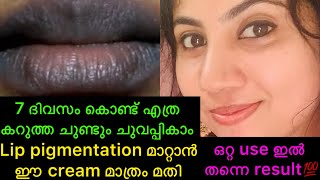 കരികട്ട ചുണ്ടും ചുമക്കാൻ ഒരു ദിവസം മതി 💯live result lipcarelippigmentation [upl. by Carolyn961]