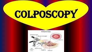 What is a Colposcopy  Colposcopy  Biopsy Purpose Procedure Risks and Results [upl. by Kwei]