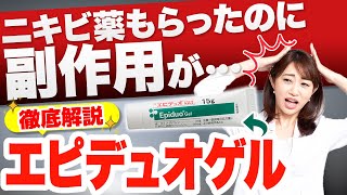 ニキビ治療薬エピデュオゲルとは？✅ニキビを治す効果✅副作用✅副作用を軽減する塗り方を皮膚科医が徹底解説  ベピオ  ディフェリン [upl. by Sydel862]