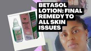 Betasol lotion Final Remedy to all skin issues skinremedy darkspotremover clobetasol skin [upl. by Enilegna879]