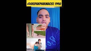 What is anti allergic drug use side effects Deepakpharmacist1992 [upl. by Anigriv]