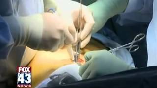 Video Assisted Thoracic Surgery [upl. by Leivad]