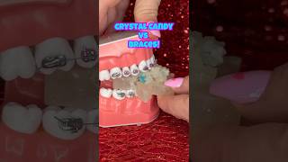 Are crunchy CRYSTAL CANDIES safe for BRACES ASMR eating shorts asmr braces [upl. by Cristobal]