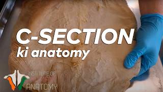 CSection ki Anatomy in Hindi [upl. by Ainosal248]