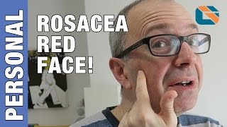 Rosacea  Geek Vlog 374 [upl. by Lak805]