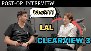 Patient Interview after having both the Clearview 3 amp LAL after LASIK [upl. by Conlin357]