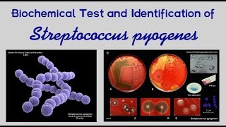 Pharyngitis Part 2 Bacterial Pharyngitis Streptococcus Pyogenes [upl. by As393]