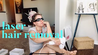 At Home Hair Removal BOSIDIN Laser from AMAZON  UNBOXING plus First Treatment [upl. by Uhn972]