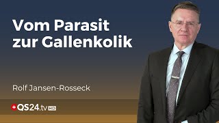 Würmer als Ursache von Gallenkoliken Seltene aber gefährliche Komplikation  QS24 [upl. by Daune]