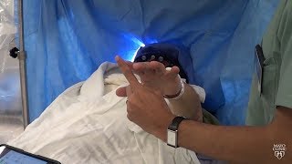 Dr Mark Lyons  Deep Brain Stimulation Precision Using Segmented Leads [upl. by Ailene708]