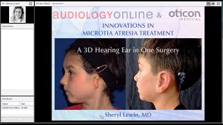 Innovations in Microtia Atresia Treatment A 3D “Hearing” Ear in One Surgery [upl. by Nadaba]