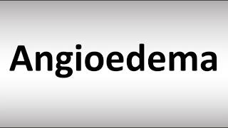 How to Pronounce Angioedema [upl. by Sixla]