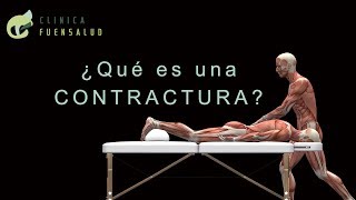 ¿Qué es una contractura [upl. by Shanks498]