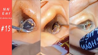 Impacted Ear Wax RemovalEP15  NN Ear cleaning [upl. by Acacia]