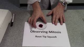 Mitotic Index Root Tip Squash [upl. by Francois]