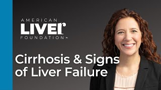 Progression of Liver Disease Webcast Series Cirrhosis and Signs of Liver Failure [upl. by Hills611]