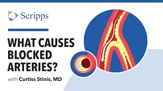 Coronary Artery Disease Causes Symptoms and Treatment with Dr Curtiss Stinis  San Diego Health [upl. by Aener]