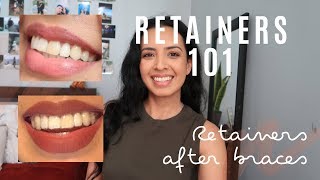 RETAINERS 101  THINGS to KNOW  TEETH LIFE after getting my braces taken off [upl. by Rem]