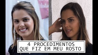 4 PROCEDIMENTOS QUE FIZ EM MEU ROSTO [upl. by Durstin646]