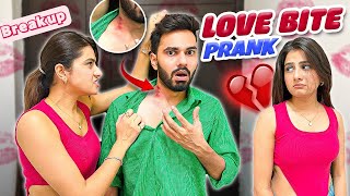 Hickey Prank Gone Wrong 😱 Ayushyadav [upl. by Pelson]