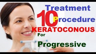 Keratoconus Treatment English [upl. by Eikram]