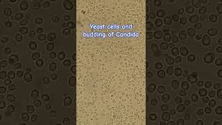 Yeast cells and budding of Candida [upl. by Eliathas117]