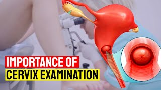 How to Test Your Cervix for Pregnancy at Home  Importance of Cervix Examination for Womens Health [upl. by Geesey67]