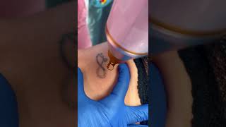 Eliminación de tatuajes con láser lasertattooremoval miami [upl. by Cherie]