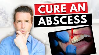 Dentist Explains a Tooth Abscess  How to Cure an Abscess Tooth [upl. by Enoryt442]