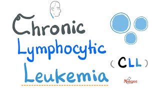 Chronic Lymphocytic Leukemia CLL  Etiology Risk Factors Symptoms Signs Diagnosis Treatment [upl. by Deborah]