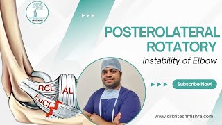 Posterolateral Rotatory Instability PLRI of Elbow [upl. by Ydnat]