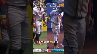 Acuna Torn ACL Again  mlb baseball sports shortsfeed shorts braves atlanta acuña injury [upl. by Eltrym31]