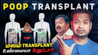 ESP  💩 மலம் மாற்று சிகிச்சையா 😳 PooP Transplant  DrKu Sivaraman  MrGK [upl. by Theobald]