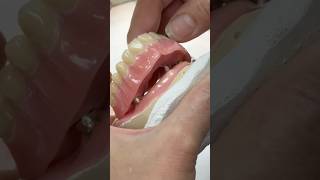 Making a betterfitting Denture lsk121shorts dentistteeth dentistry [upl. by Girish]