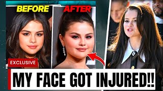 Selena Gomez Plastic Surgery Analysis selenagomez [upl. by Lahcear857]